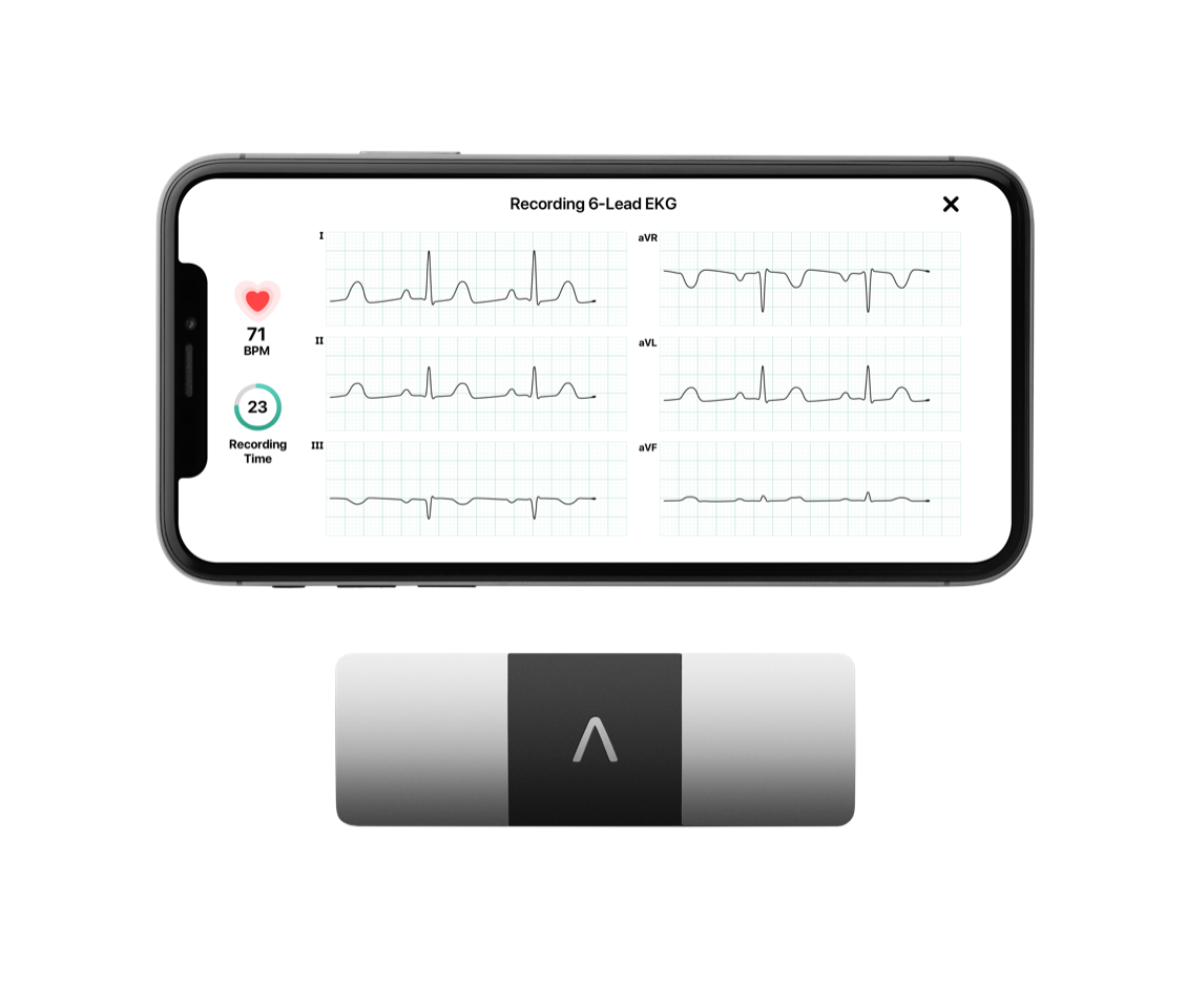Remote ECGs